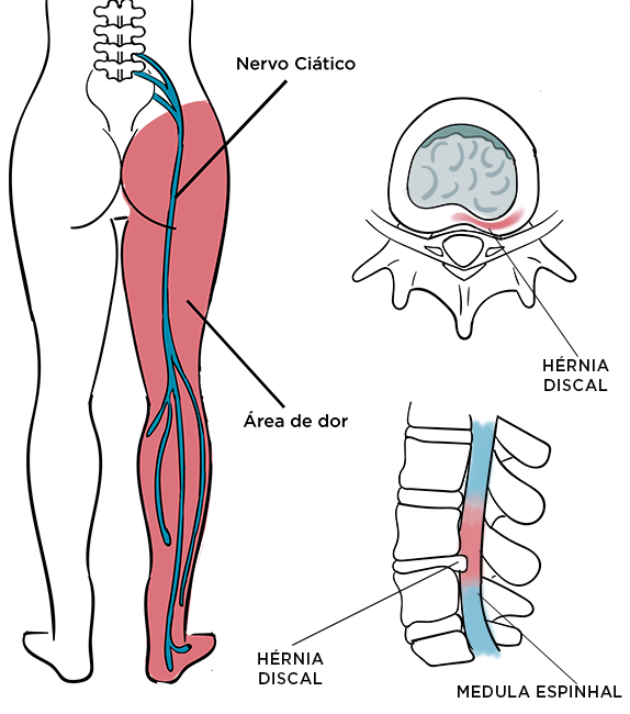 Clínica Yamada - Patologias